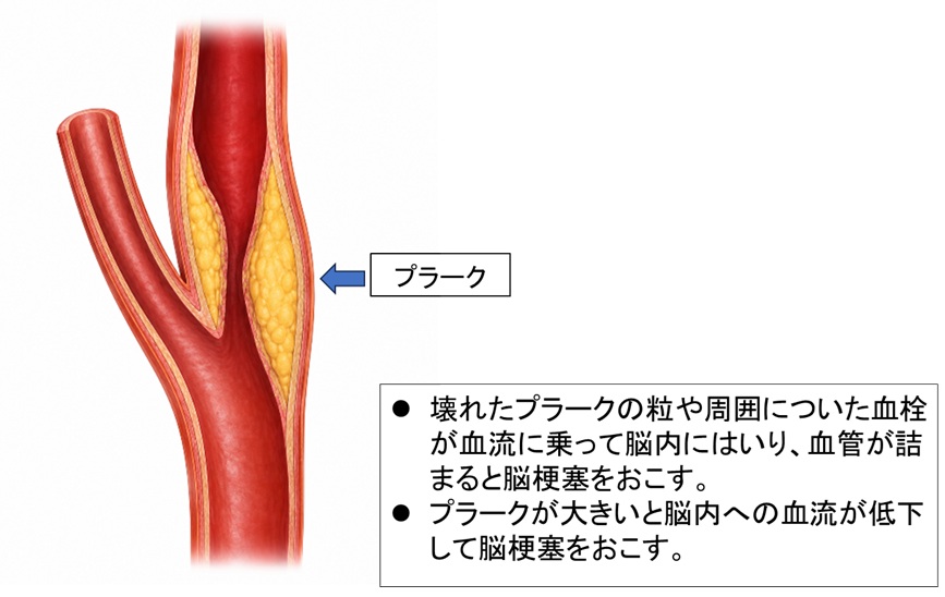 プラーク