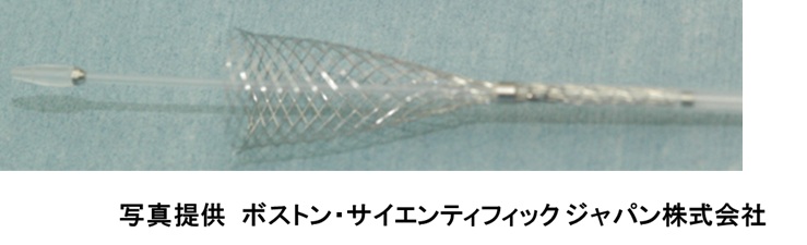 ステント