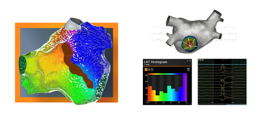 CARTO®3 Version7(Biosense Webster / Johnson and Johnson)