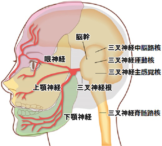 三叉神経痛