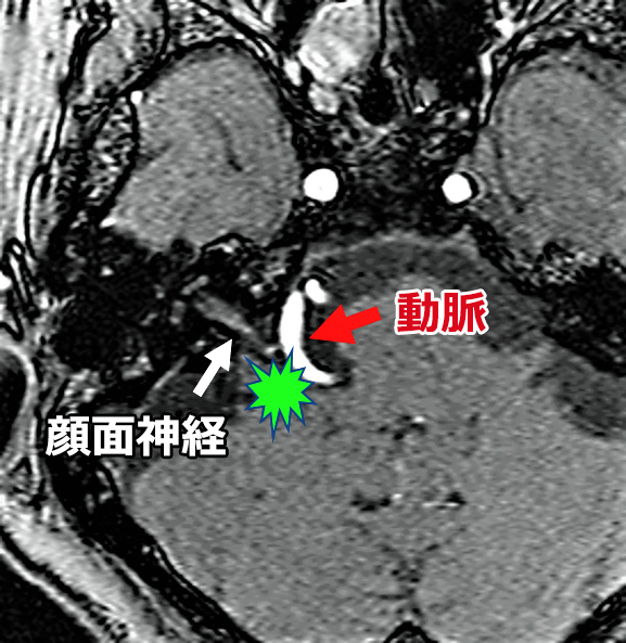 診断　図1