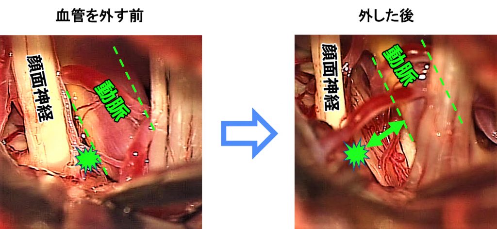 治療法　図