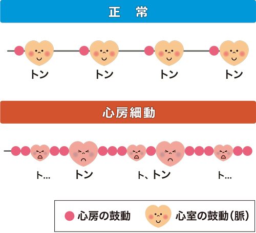 脈の間隔