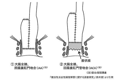 図15-3