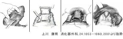 再建シェーマ