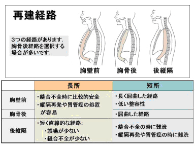 再建経路