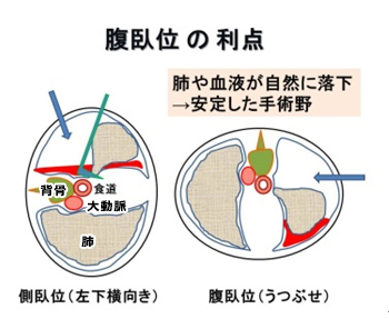 腹臥位の利点