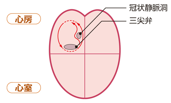 心房粗動