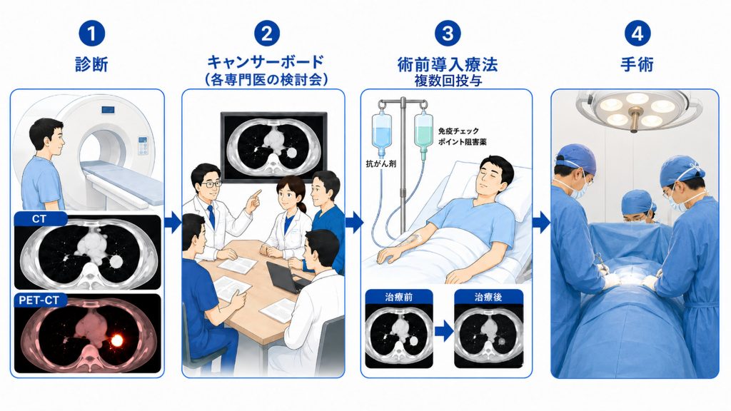 術前免疫治療と手術図